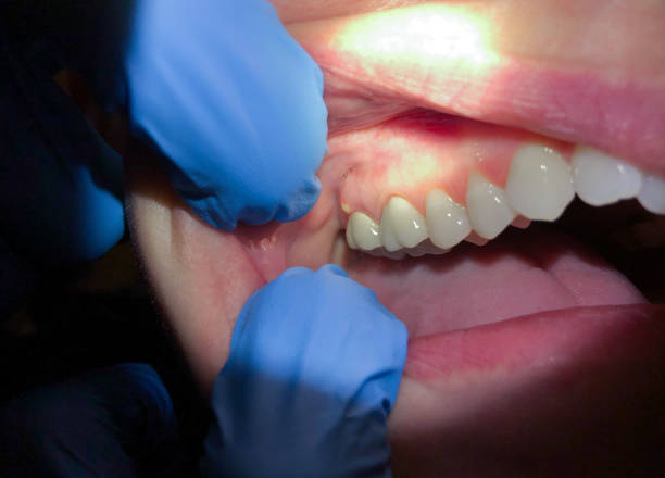 Best Walk-In Emergency Dentist in De Queen, AR